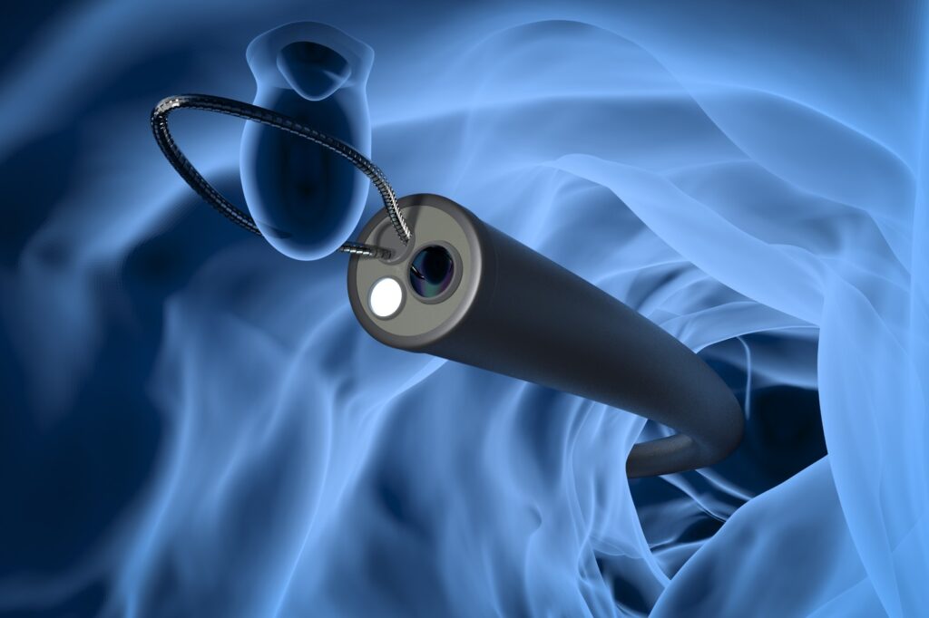 endoscopia 1