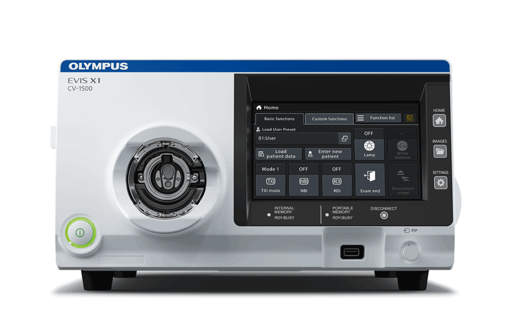 Cuide da saúde digestiva com Endoscopia e Colonoscopia 3 endoscopia 2